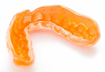 Picture of a mouth guard to prevent teeth grinding.